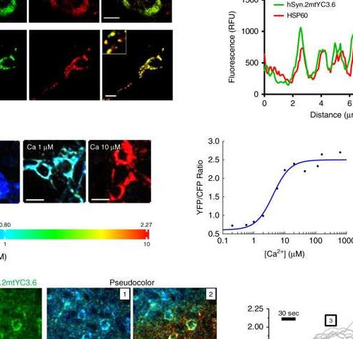 Researchers link high calcium levels in mitochondria to neuronal death in Alzheimer’s disease