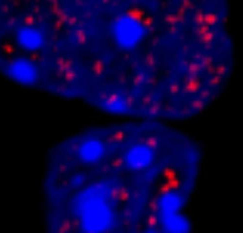 Unexpectedly potent protein droplets help explain hereditary diseases