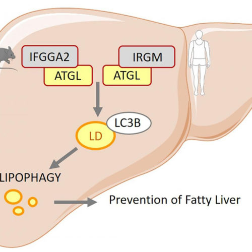 Additional genetic cause for non-alcoholic fatty liver disease discovered