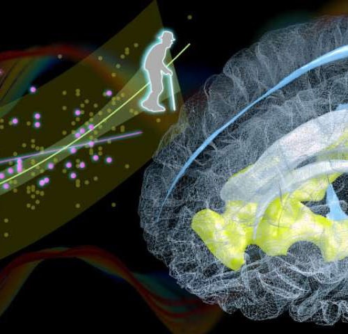 A new biomarker for the aging brain