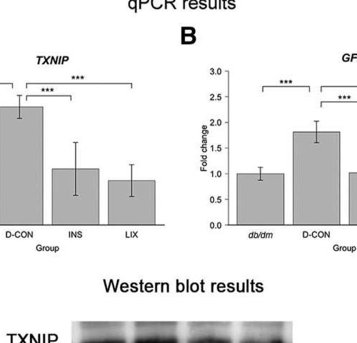 Scientists identify a potential treatment candidate for early type 2 diabetic retinopathy