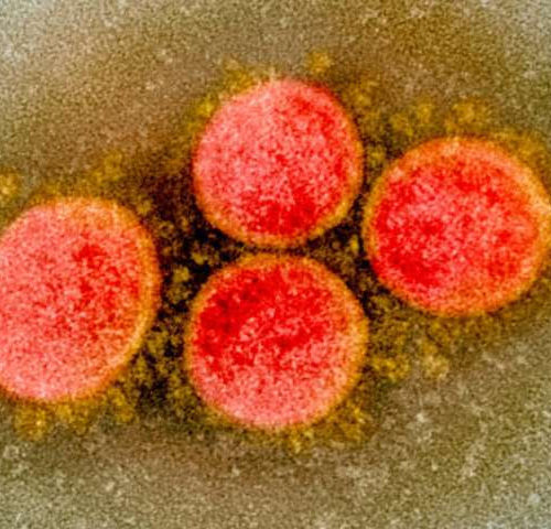 COVID-19 cytokine storm: Possible mechanism for the deadly respiratory syndrome