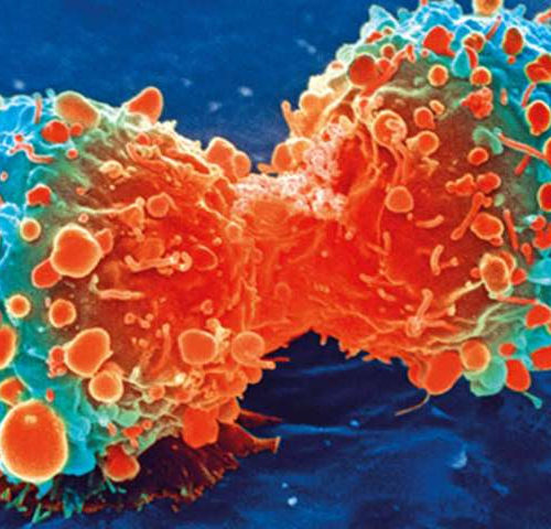 New liver cancer research targets non-cancer cells to blunt tumor growth