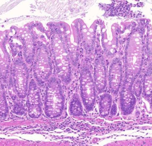 Uncovering how ‘dark matter’ regions of the genome affect inflammatory diseases