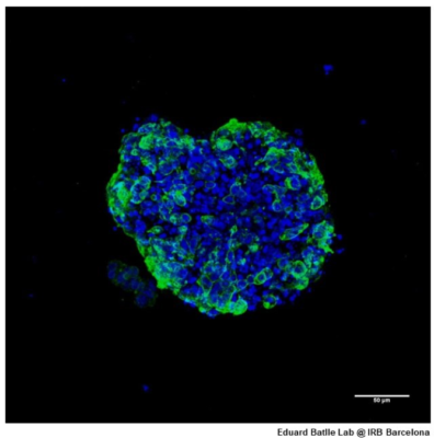 First Epigenetic Study in 3D Human Cancer Cells