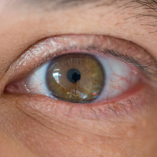 Could a drug combination prevent people with the eye disease uveitis lose their sight?