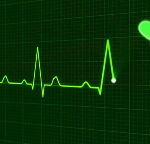 Scientists discover more than 200 genetic factors that cause heart arrhythmia