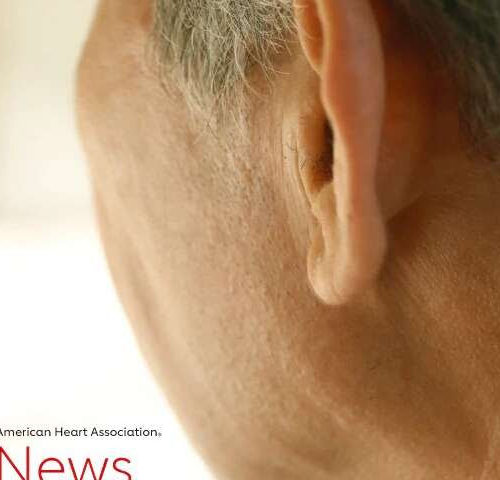 Hearing loss and the connection to Alzheimer’s disease, dementia