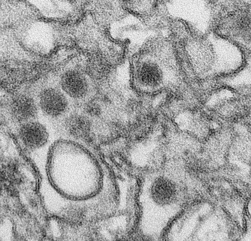 Zika infection soon after birth leads to long-term brain and behavior problems