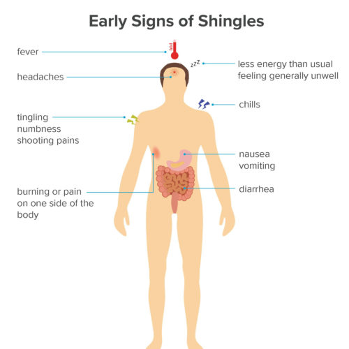What are the early signs and symptoms of shingles?