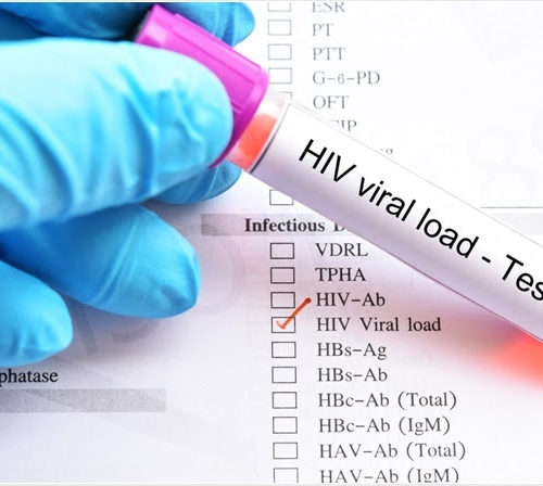 What is Viral Load?