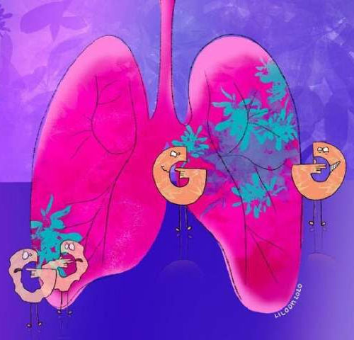 Blocking sugar metabolism slows lung tumor growth