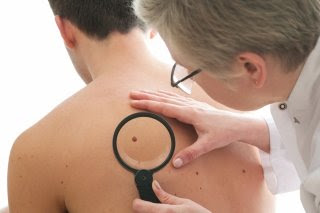 Skin cancer: men are genetically more prone