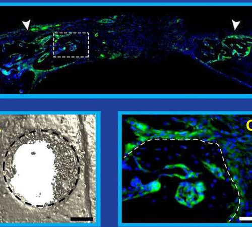 Study shows nervous and immune systems ‘need to talk’ for bone repair