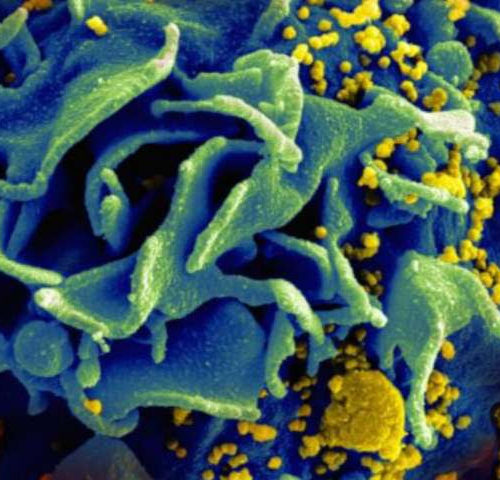 Existing drugs may limit damage caused by HIV