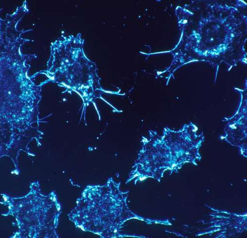 Blocking tumor signals can hinder cancer’s spread