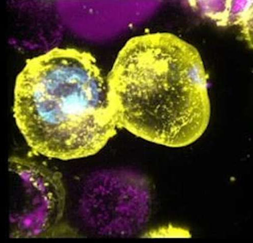 New light shone on inflammatory cell death regulator