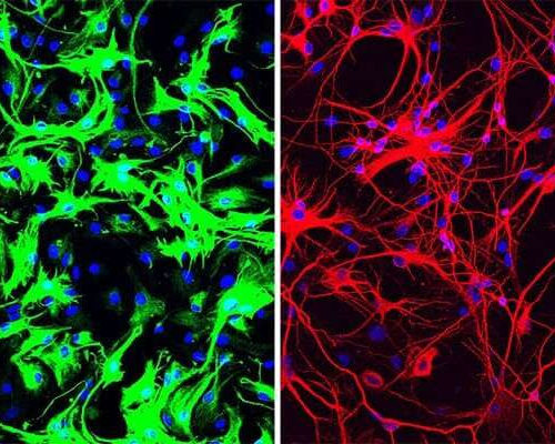 One-time treatment generates new neurons, eliminates Parkinson’s disease in mice