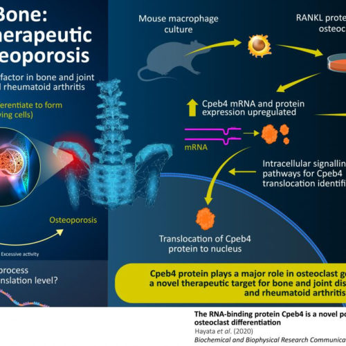 Down to the bone: Understanding how bone-dissolving cells are generated