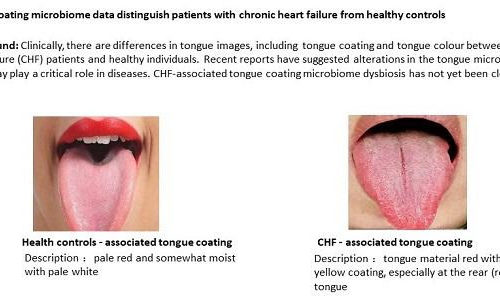 Tongue microbes provide window to heart health