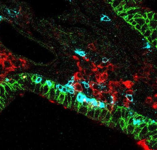 How targeting killer T cells in the lungs could lead to immunity against respiratory viruses