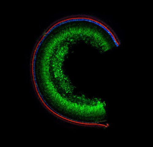 Gene therapy with a new base editing technique restores hearing in mice