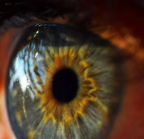 Seeing corneal degeneration in a new light