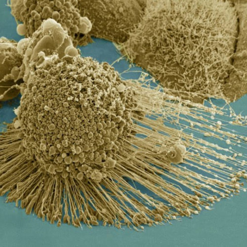 Cancer cells adapt to lack of key nutrient, posing potential problems for drugmakers