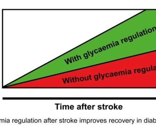 The regulation of glycemia after stroke improves neurological recovery in diabetes