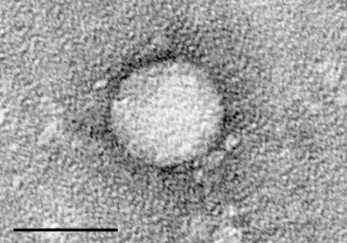 Virus co-opts immune protein to avoid antiviral defences