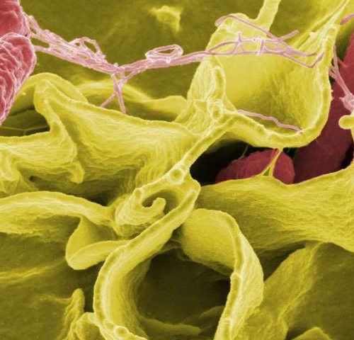 Reactive arthritis is fueled by amyloid protein during salmonella infection