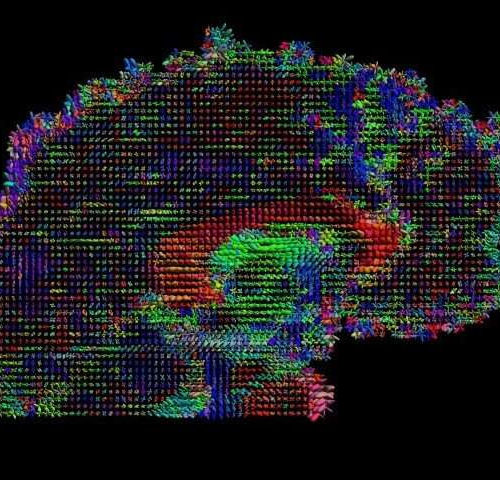 Brain thickness and connectivity, not just location, correlate with behavior