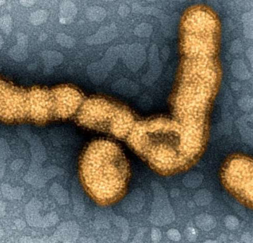 New swine flu strain found in China poses threat of pandemic