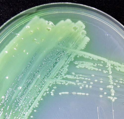 Not as gross as it sounds: predicting how bacteria in mucus affect human health