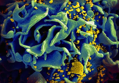 HIV pre-exposure drug regimen highly effective in preventing infection