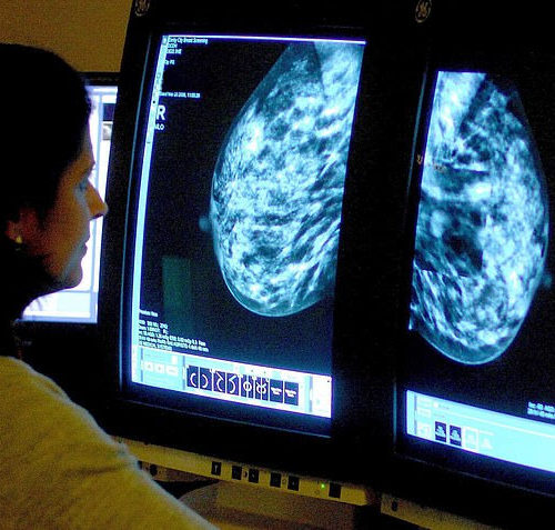 Cancer vaccine hope: Personalised treatment designed to boost the body’s natural ability to fight the disease shows ‘promising signs’ in clinical trials