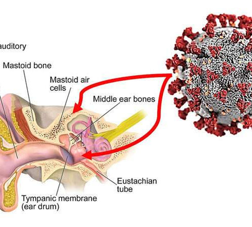 Have you heard? Middle ear, mastoid harbor SARS-Cov-2 and may pose risk for medical staffs