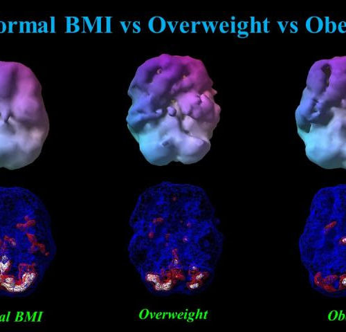 Body weight has surprising, alarming impact on brain function
