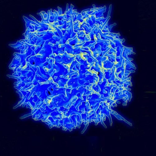 New tool identifies which cancer patients are most likely to benefit from immunotherapy