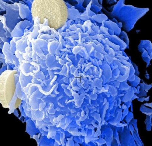 A metabolic enzyme as a potential new target for cancer immune therapies