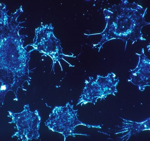 Researchers discover cell communication mechanism that drives cancer adaptation