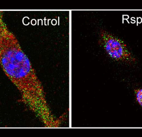 Reprogramming immune cells to reduce inflammation, promote tissue repair