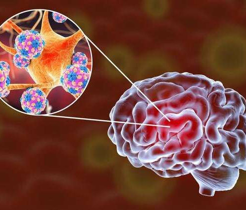 Scientists prove SARS-CoV-2 potential to infect human brain organoids