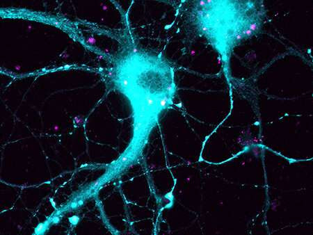 Study targets gene associated with Alzheimer’s disease