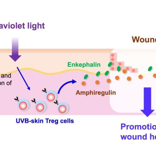 Ultraviolet B exposure expands proenkephalin+ regulatory T cells with a healing function