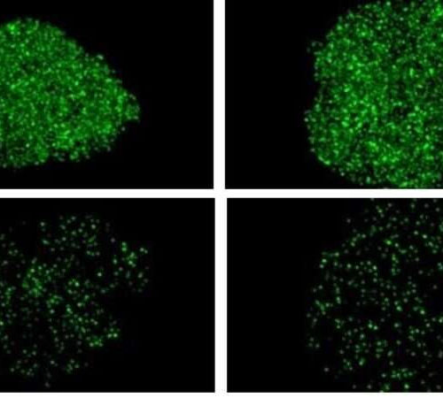 Brain cell death in ALS, dementia tied to loss of key biochemical transport structure in nucleus