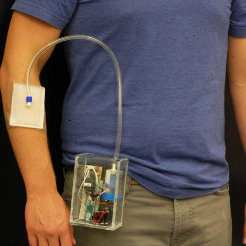 Wearable, portable invention offers options for treating antibiotic-resistant infections