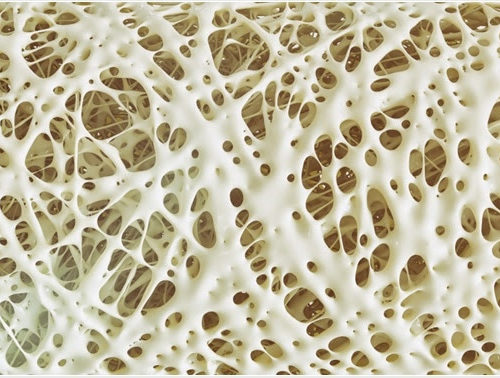 Risk Factors of Osteoporosis