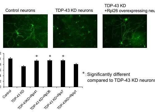 Faulty transportation of messenger RNA is the culprit in neurodegenerative diseases