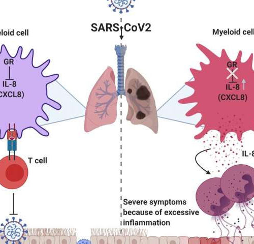 Biomarker predicts who will have severe COVID-19